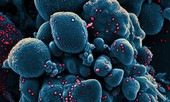Hình ảnh virus SARS-CoV-2 tấn công tế bào