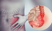 Cách giảm đau đại tràng nhanh, hiệu quả của người Nhật