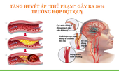 Xu hướng mới trong điều trị tăng huyết áp và phòng ngừa đột quỵ