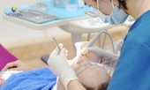 Superplas 6D – Đột phá trong giải pháp phục hình răng sứ thẩm mỹ siêu tương thích