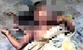 Thanh niên nguy kịch vì điện thoại phát nổ khi đang sạc