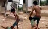 Diễn biến sức khỏe bé gái bị cha đánh đập dã man như thời trung cổ