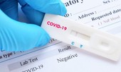 Lều dã chiến xét nghiệm nhanh COVID-19 tại Hà Nội được đặt ở đâu?