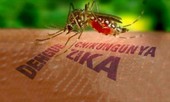 Nam thanh niên Đà Nẵng mắc bệnh Zika cực kỳ nguy hiểm do muỗi đốt