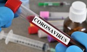 Hôm nay 4 ca mắc COVID-19 đều từ nước ngoài về được công bố khỏi bệnh