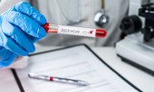 Bộ Y tế thông báo khẩn về xét nghiệm COVID-19