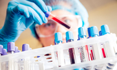 Bộ Y tế thông tin về kết quả xét nghiệm PCR của 2.672 người dân Hà Nội