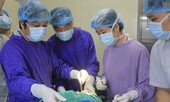 Nghĩ bị tưa lưỡi, người phụ nữ không ngờ mắc căn bệnh dẫn tới ung thư miệng