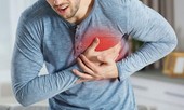 1/3 người bị đột quỵ ở Việt Nam trẻ tuổi, bác sỹ chỉ rõ nguyên nhân