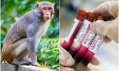 Chỉ có thể ở Ấn Độ: Bầy khỉ giật và ném các mẫu máu của bệnh nhân COVID-19