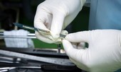Các bác sĩ thực hiện ca mổ hiếm gặp, cứu em bé 2 tuổi nuốt 2 viên nam châm