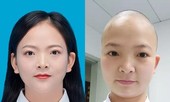 Nữ y tá ở 'tâm bão' Vũ Hán cạo trọc đầu để tránh lây nhiễm chéo virus corona