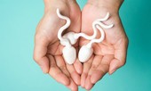 Liệu đồ ăn hàng ngày có khả năng làm thay đổi mùi của tinh dịch không?
