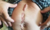 Chủ tịch một tập đoàn ở Sài Gòn bị đâm thủng bụng, thương tích 57%