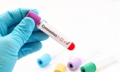 Đại học Monash phát hiện loại thuốc có khả năng điều trị COVID-19