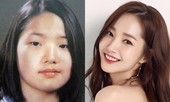 Sự thật gây sốc về bức ảnh của “Nữ hoàng dao kéo” Park Min Young trước khi thẩm mỹ