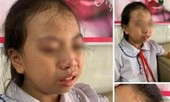 Bản tin 8H: Tạm đình chỉ cô giáo tát học sinh lớp 4 ngay trong lớp học
