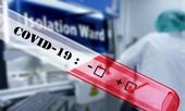 Thứ trưởng Bộ Y tế: Lo ngại nguy cơ dịch COVID-19 xâm nhâp vào Việt Nam