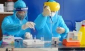 Kết quả xét nghiệm cô gái nhập cảnh trái phép theo đường mòn từ Trung Quốc