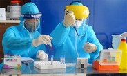 Thêm 27 ca mắc COVID-19 tại Việt Nam khỏi bệnh, trong đó có bệnh nhân 21