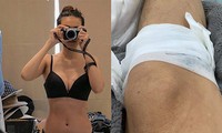 Showbiz 2/7: Hoài Linh bị... gà đá chảy máu chân, Thanh Hằng khoe vòng eo 51 gợi cảm