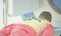Điều trị thành công ung thư hạch bằng phương pháp ghép tế bào gốc đồng loại và xạ trị toàn thân