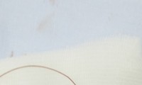 Tổn thương thị lực tới 99% vì bị lưỡi câu móc trúng mắt khi đi câu cá