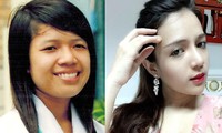 Cơ hội làm đẹp miễn phí 100% tại bệnh viện thẩm mỹ JW