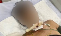 Quảng Nam: Cứu người đàn ông tự cứa cổ, đâm dao vào bụng