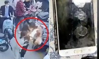 Điện thoại Samsung đang nằm trong túi bốc cháy khiến chủ nhân bị bỏng, cư dân mạng lo lắng