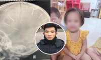 Vụ bé gái 3 tuổi ở Hà Nội bị đinh găm vào đầu: Nghi phạm lì lợm, quanh co chối tội