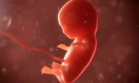 Luật mới của bang Georgia coi thai nhi cũng là con người có đầy đủ quyền pháp lý.