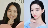 Karina (aespa) lộ ảnh quá khứ khác lạ khiến nghi vấn đụng dao kéo bùng nổ trở lại