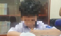 Xử lý nghiêm giáo viên tác động vật lý làm học sinh gãy ngón tay