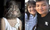 Cạo sạch lông mặt, nữ &apos;người sói&apos; Thái Lan gây sửng sốt với nhan sắc 