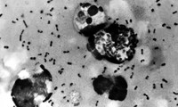 Vi khuẩn gây bệnh dịch hạch nhìn dưới kính hiển vi. (Ảnh: Shutterstock)