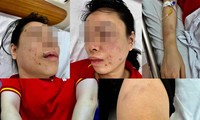 Vụ người phụ nữ ở Hà Nội tố bị ‘bắt cóc’, đánh đập dã man: Chồng cũ nạn nhân khai nhận hành vi