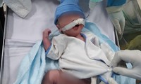 Bé trai chào đời tại phòng sinh dã chiến khi mẹ nguy kịch vì COVID-19 