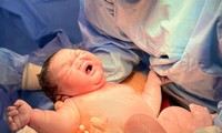 Bé trai vừa chào đời nặng 5,8 kg ở TPHCM