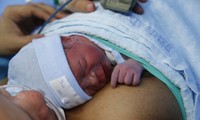 Việt Nam: Thai nhi được thông tim xuyên tử cung đầu tiên vừa chào đời