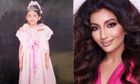 Tiết lộ bất ngờ về Á hậu 1 Miss World 2021: Từng gặp tai nạn đến biến dạng mặt