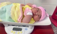 Bé gái sơ sinh chào đời với cân nặng &apos;khủng&apos; 6kg