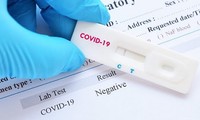 Hà Nội: 3 trường hợp dương tính test nhanh không mắc COVID-19