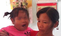 Bé 3 tuổi liệt dây thần kinh số 7 nghi do cô giáo đánh ở Thanh Hóa