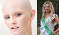 Cô gái từng chiến thắng bệnh ung thư não lên ngôi Hoa hậu Trái đất Úc 2020