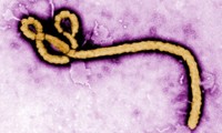 Ebola là hậu quả của chiến tranh sinh học?