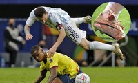 Messi bị đối thủ "chém" tung người và hệ quả là chân chảy máu