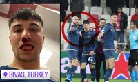 CĐV Thổ Nhĩ Kỳ làm loạn, đấm vỡ mũi đối thủ tại Cúp châu Âu