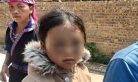 Nghi vấn học sinh lớp 1 ở Yên Bái bị giáo viên đánh tím mặt