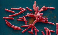Bị phát hiện mắc ‘vi khuẩn ăn thịt người’ sau khi đau bụng dữ dội